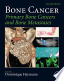 Bone cancer : primary bone cancers and bone metastases /