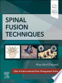 Spinal fusion techniques /