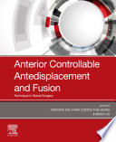 Anterior controllable antedisplacement and fusion : technique in spinal surgery /