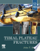 Tibial plateau fractures /