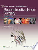 Reconstructive knee surgery /