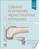Calipered kinematically aligned total knee arthroplasty : theory, surgical techniques and perspectives /