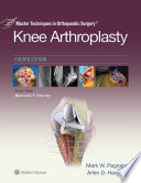 Knee arthroplasty /