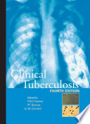 Clinical tuberculosis /