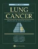 Lung cancer : principles and practice   /