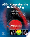 ASE's comprehensive strain imaging /