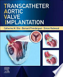Transcatheter aortic valve implantation /