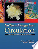 Ten years of images from Circulation, journal of the American Heart Association /