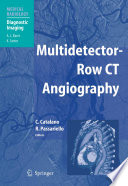 Multidetector-row CT angiography /