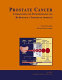 Prostate cancer : understanding the pathophysiology and re-designing a therapeutic approach /