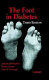 The foot in diabetes /