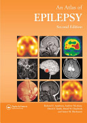 Atlas of epilepsy /