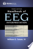 Handbook of EEG interpretation /