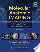Molecular anatomic imaging : PET-CT and SPECT-CT integrated modality imaging /
