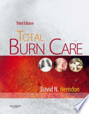 Total burn care /