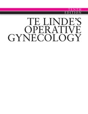 Te Linde's operative gynecology.
