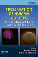 Preservation of human oocytes /