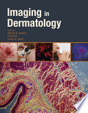 Imaging in dermatology /