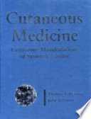 Cutaneous medicine : cutaneous manifestations of systemic disease /