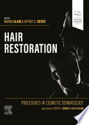 Hair restoration /