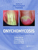 Onychomycosis : the current approach to diagnosis and therapy /