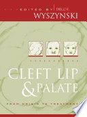 Cleft lip and palate : from origin to treatment /