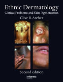Ethnic dermatology : clinical problems and skin pigmentation /