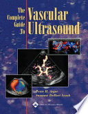 The complete guide to vascular ultrasound /