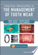 Practical procedures in the management of tooth wear /