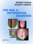 The nail in differential diagnosis /