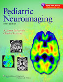 Pediatric neuroimaging /