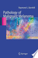 Pathology of malignant melanoma /
