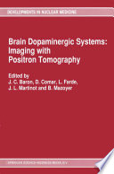 Brain Dopaminergic Systems: Imaging with Positron Tomography : Proceedings of a Workshop held in Caen, France within the framework of the European Community Medical and Public Health Research /