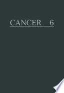 Radiotherapy, Surgery, and Immunotherapy /