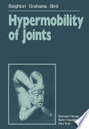 Hypermobility of Joints /