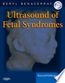 Ultrasound of fetal syndromes /