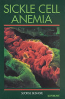 Sickle cell anemia /