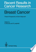 Breast Cancer : Present Perspective of Early Diagnosis /