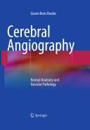 Cerebral angiography : normal anatomy and vascular pathology /