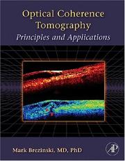 Optical coherence tomography : principles and applications /