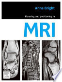 Planning and positioning in MRI /