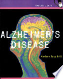 Alzheimer's disease /