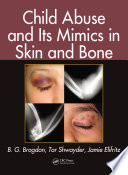 Child abuse and its mimics in skin and bone /