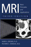 MRI : basic principles and applications /