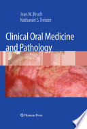 Clinical oral medicine and pathology /