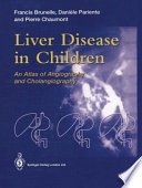 Liver disease in children : an atlas of angiography and cholangiography /
