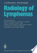 Radiology of Lymphomas /