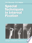 Special Techniques in Internal Fixation /