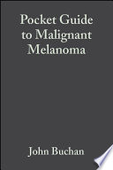Pocket guide to malignant melanoma /