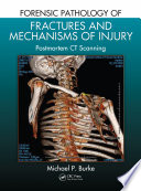 Forensic pathology of fractures and mechanisms of injury : postmortem CT scanning /